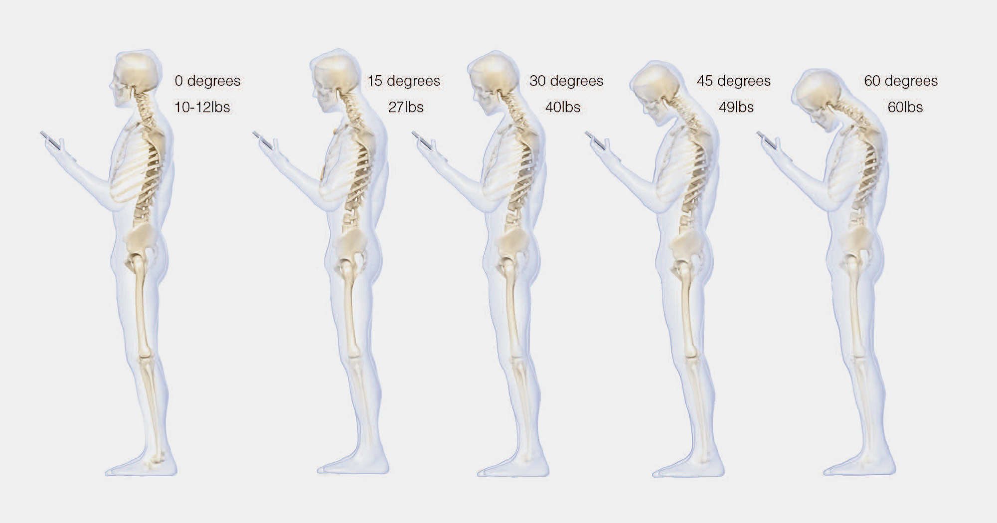 The 20-Second Cure For Smartphone Neck 1
